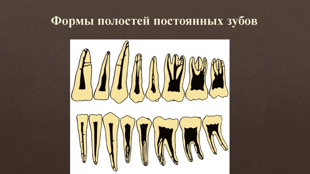 Полость формы. Форма постоянных зубов. Формы полостей зубов.