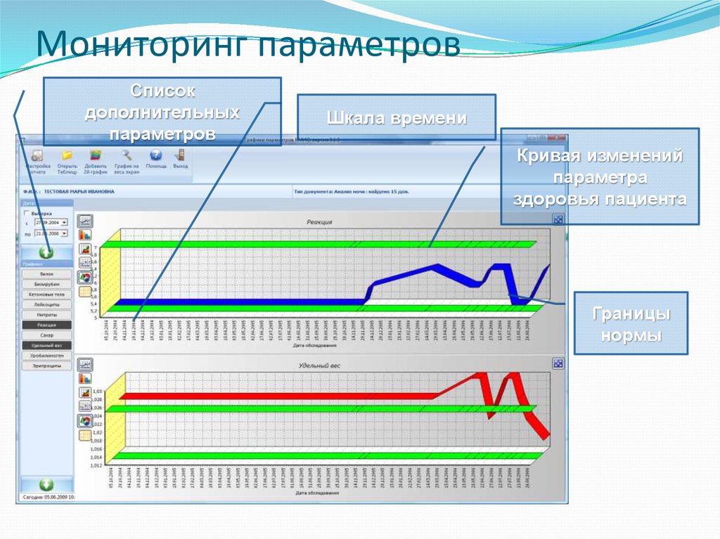 Мониторинг параметров. Параметры мониторинга в медицине. Основные параметры мониторинга. Параметры программы наблюдения.