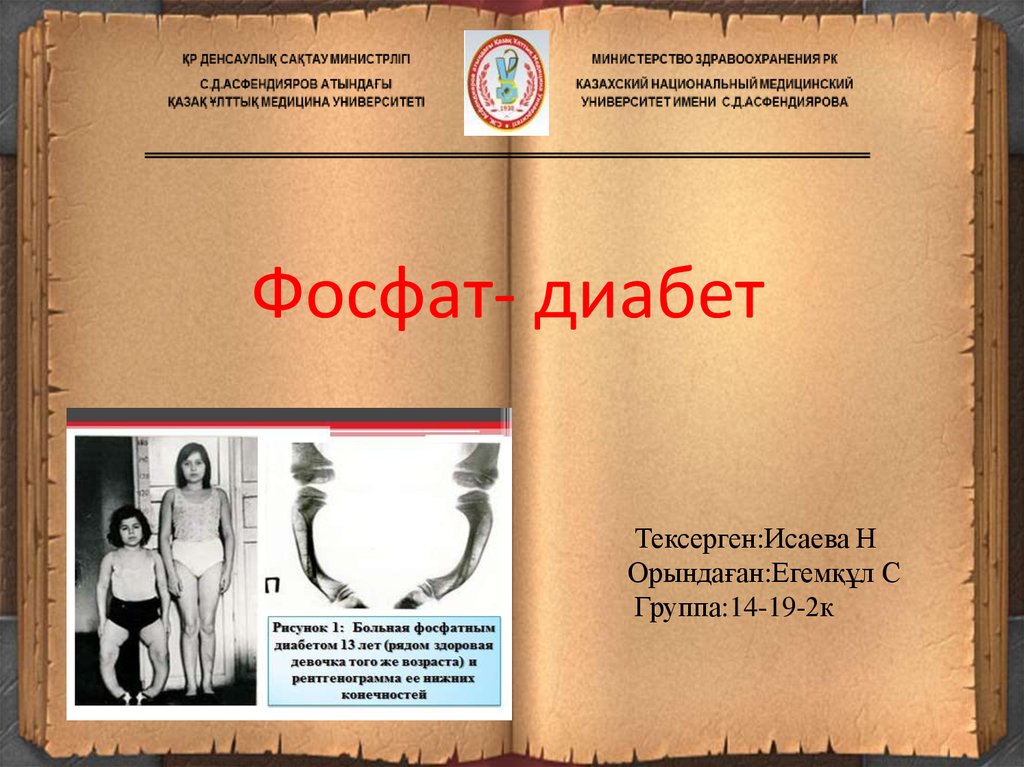 Фосфат диабет. Фосфат диабет презентация. Фосфат диабет клинические формы. Фосфат диабет у детей клинические рекомендации.