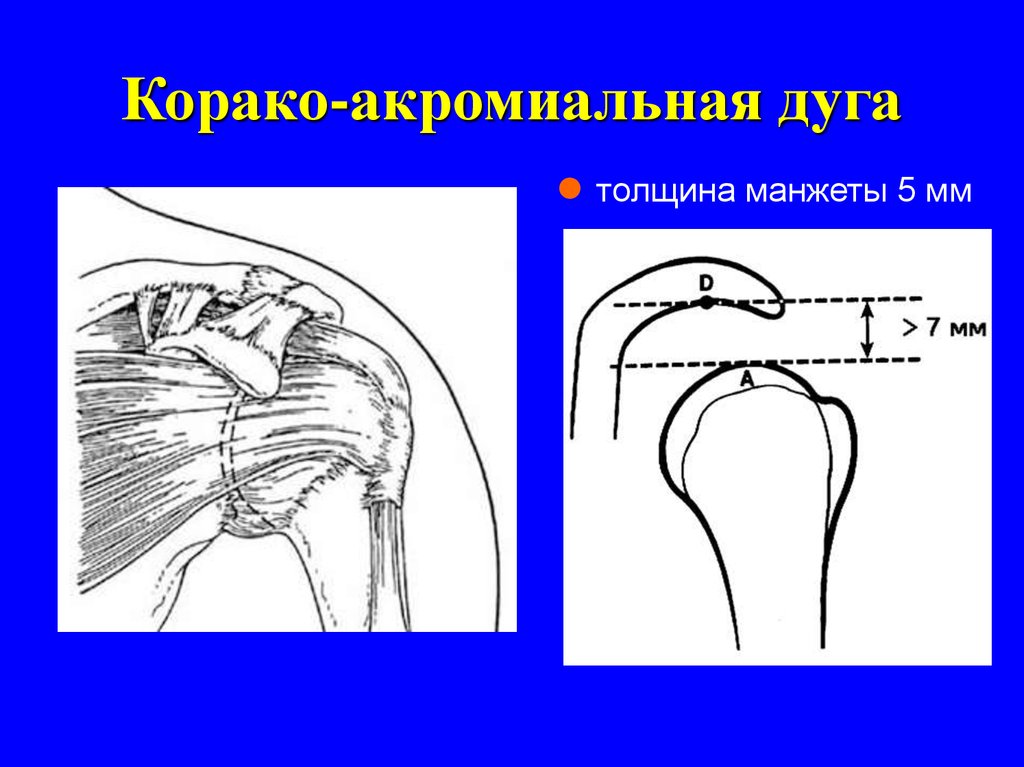 Карман риделя травматология рисунок