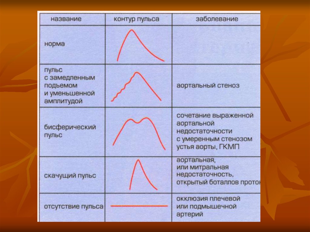 Виды пульса. Отсутствие пульса называется. Скачки пульса. Пульс название. Пульс виды пульса.