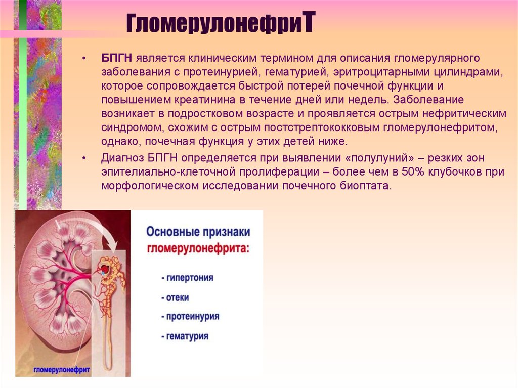 Гломерулонефриты у детей презентация