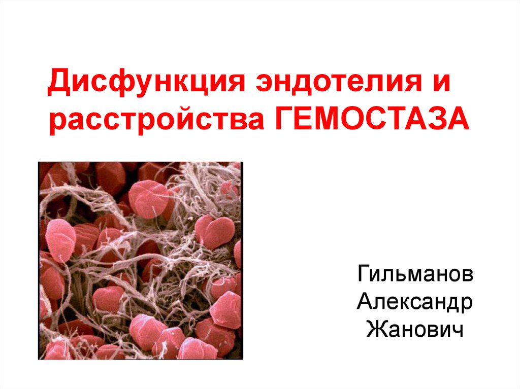 Патология гемостаза презентация