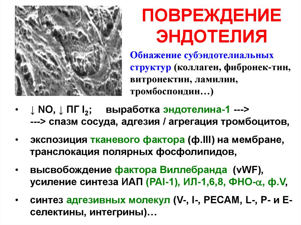 Эндотелиальная дисфункция презентация