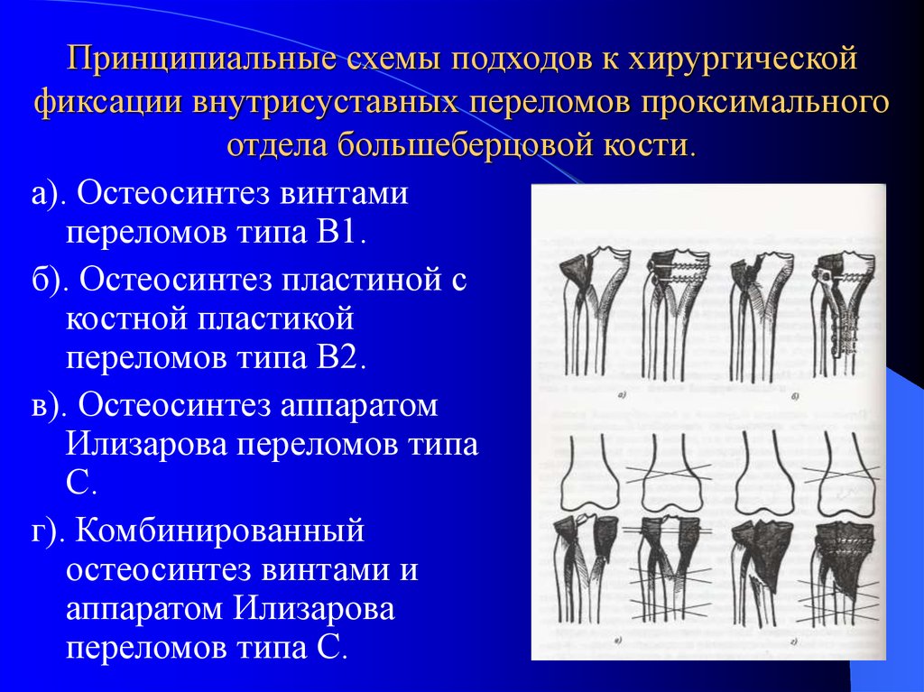 Повреждения и заболевания коленного сустава презентация