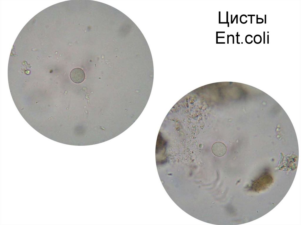 Entamoeba coli в кале. Цисты Entamoeba. Цисты микроскопия. Entamoeba coli циста.