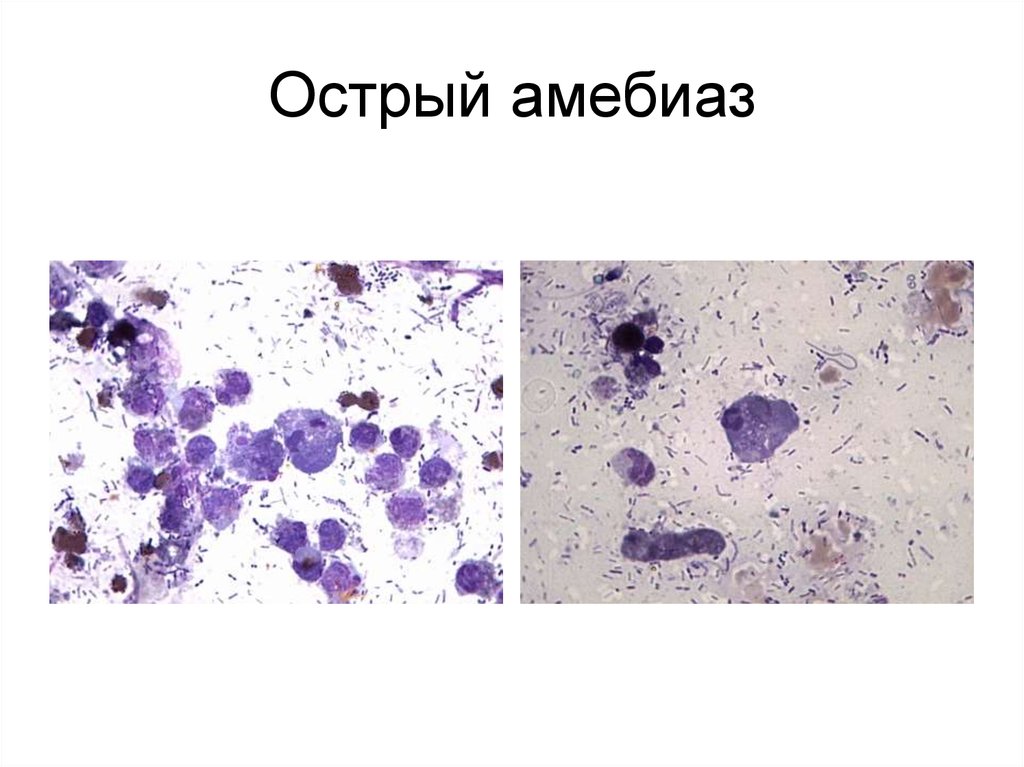 Презентация амебиаз микробиология