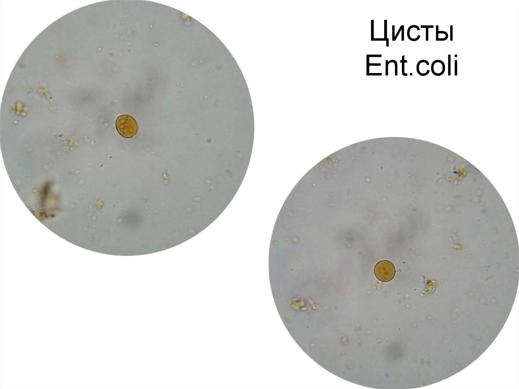 Какое значение в жизни простейших имеют цисты. Циста амебы. Цисты лямблии микроскопия. Цисты микроскопия. Микроб циста.