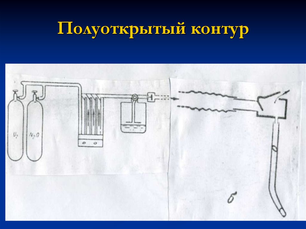 Открытый контур. Полузакрытый контур наркозного аппарата. Полуоткрытый контур. Полузакрытый и полуоткрытый контур. Полуоткрытый контур наркозного аппарата.