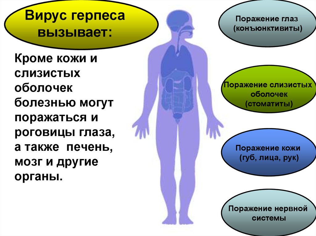 Может ли взрослого человека. Типы герпеса и заболевания. Вирус герпеса заболевания. Герпетическая инфекция внутренних органов.