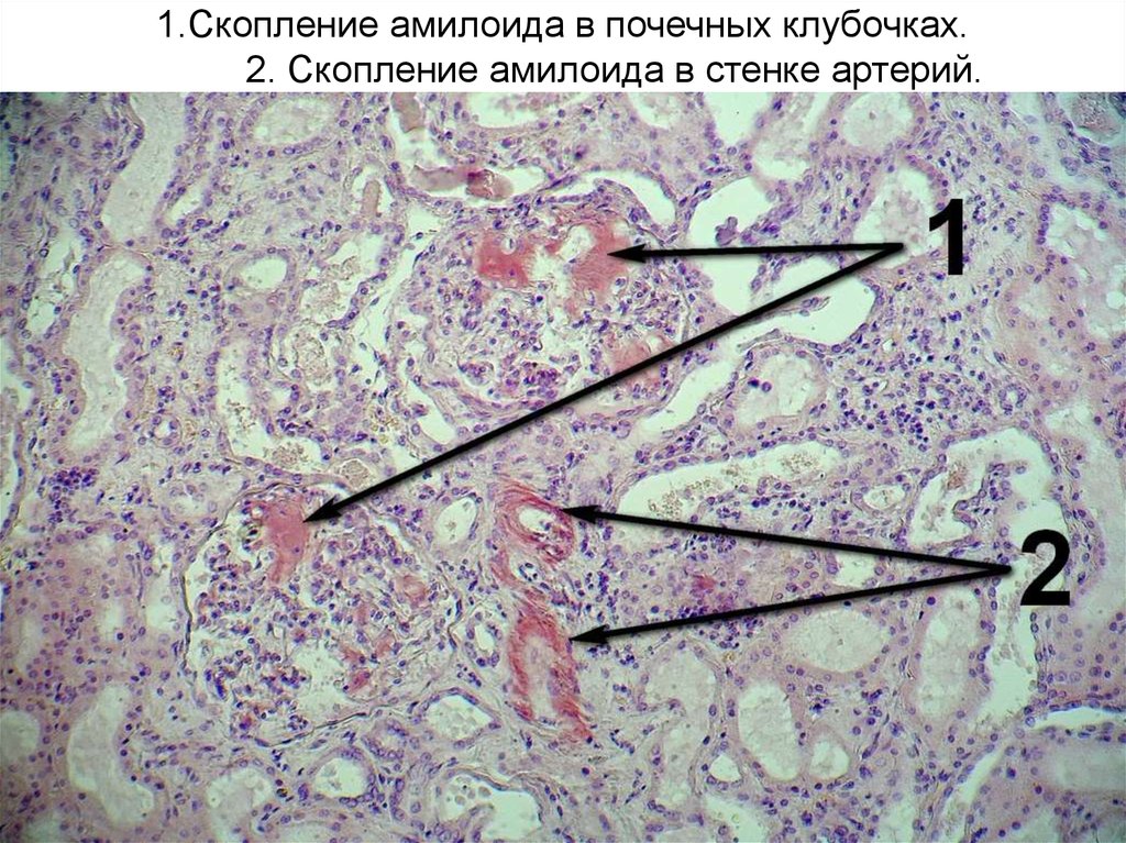 Мезенхимальные опухоли патанатомия презентация