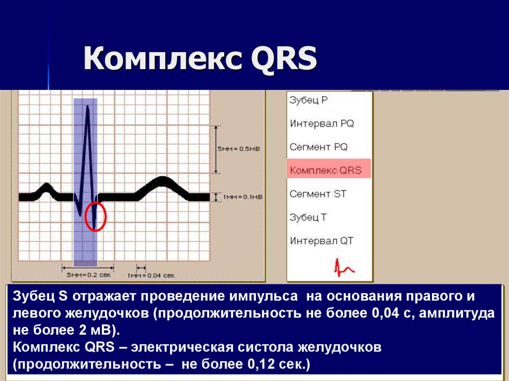 Qrs на экг что это. ЭКГ комплекс QRS В v2. Комплекс зубцов QRS на ЭКГ. Зубцов QRS на ЭКГ отображает. Комплекс QRST на ЭКГ отражает.