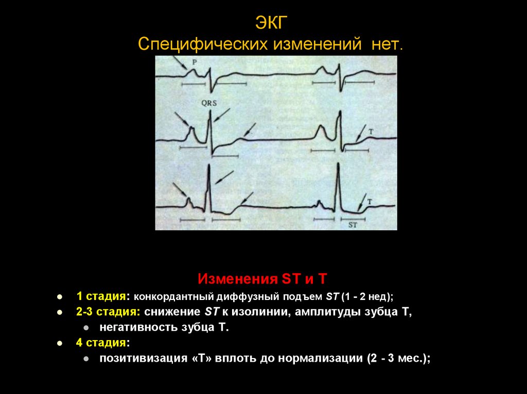 Изменение т