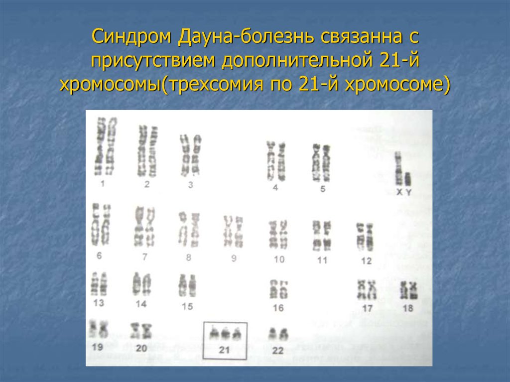 Проект по теме генетика и наследственные болезни человека