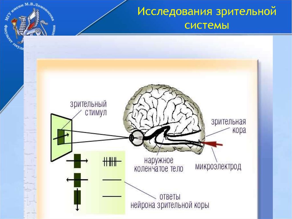 Нарушения зрительной коры