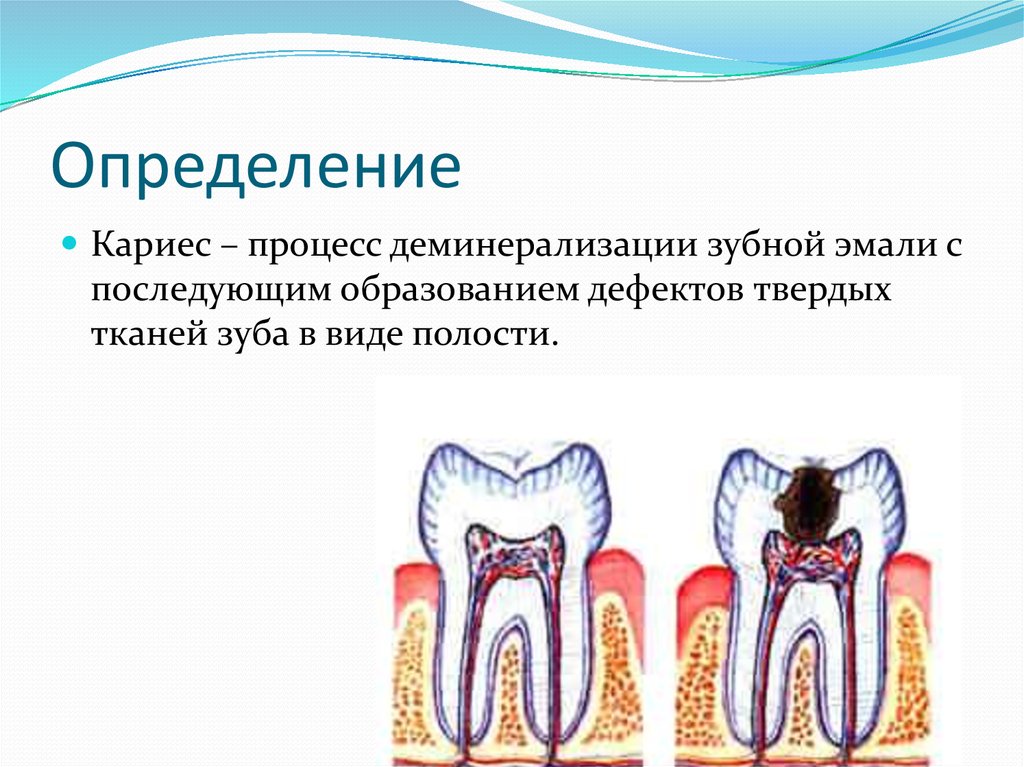 Определение