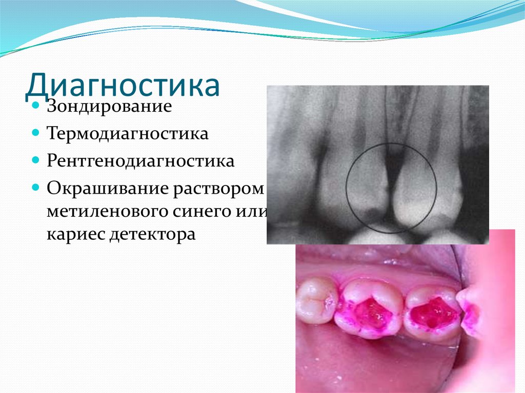 Диагностика