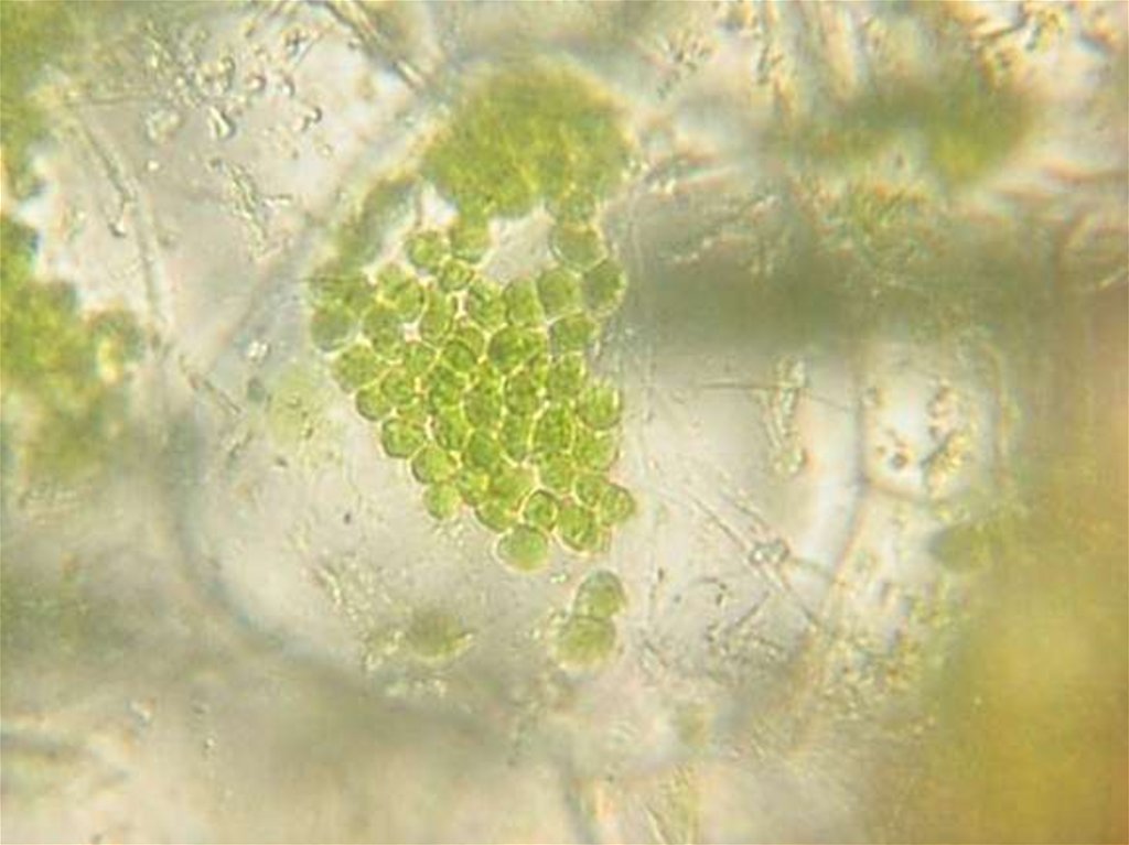 Хлоропласты в клетках листьев крупные. Хлоропласт под микроскопом. Наблюдение под микроскопом пластидов. Хлоропласт фото. Хлоропласты под микроскопом фото.