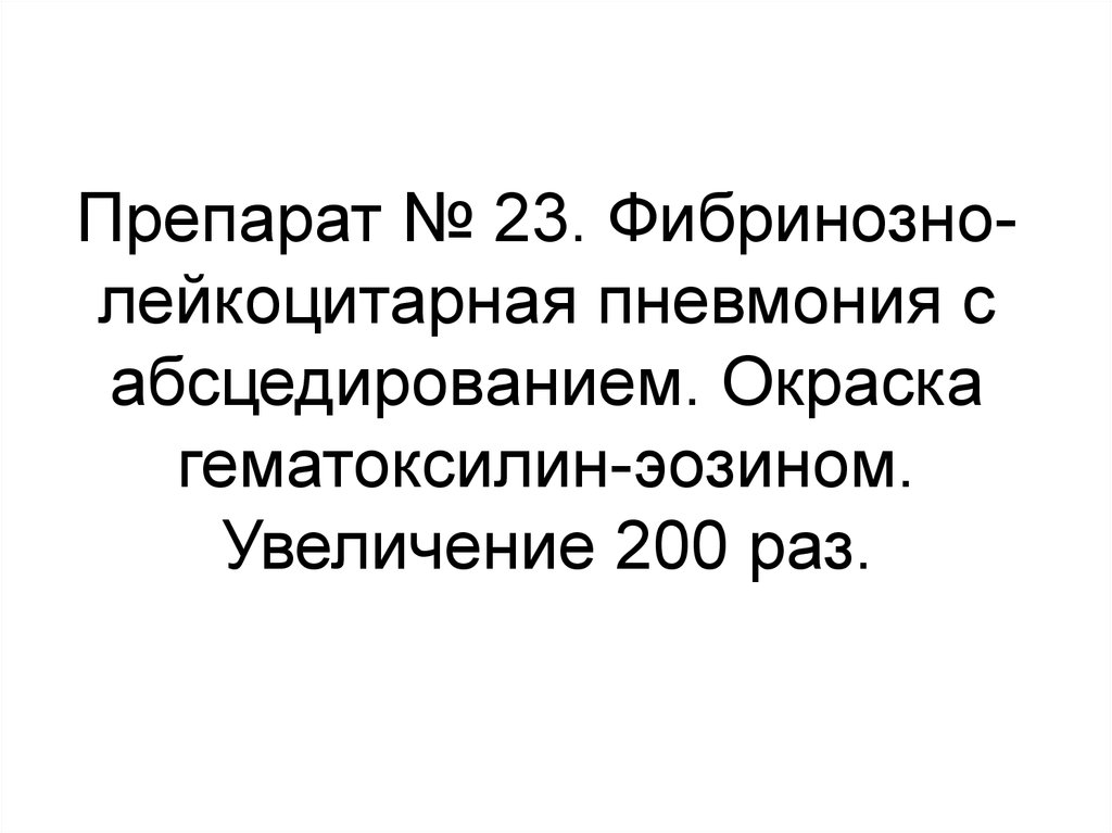 Увеличение 200