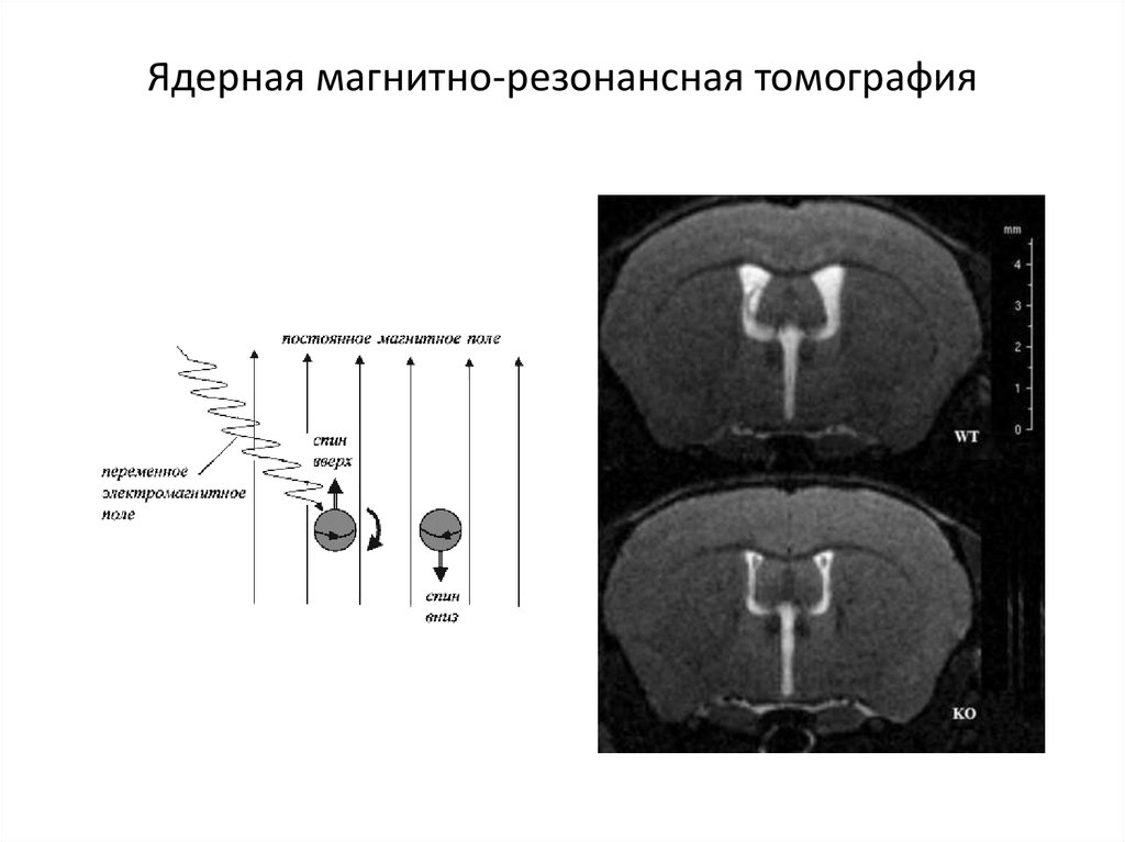 Магнитное исследование. Ядерная магнитная резонансная интроскопия. Ядерно-магнитный резонанс томография. Ядерная магнитно-резонансная томография спинного мозга. Магнитно - резонансная томография (ЯМР).