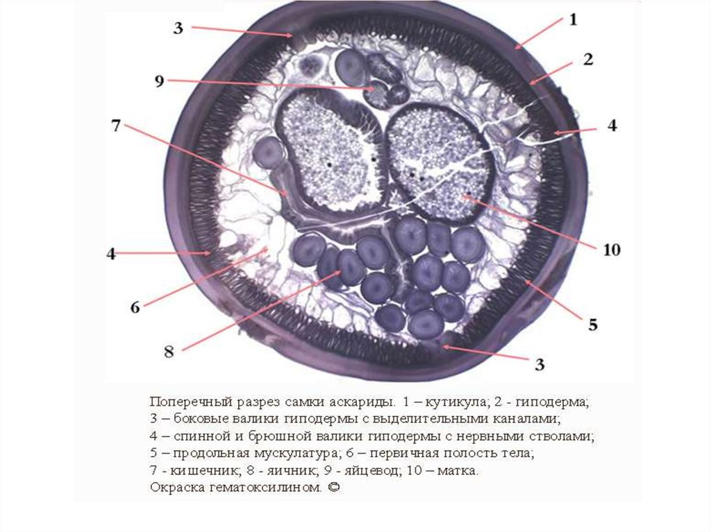 Поперечный разрез. Препарат: поперечный срез Ascaris lumbricoides. Поперечный срез самки аскариды. Поперечный срез тела аскариды. Поперечный срез аскариды препарат.