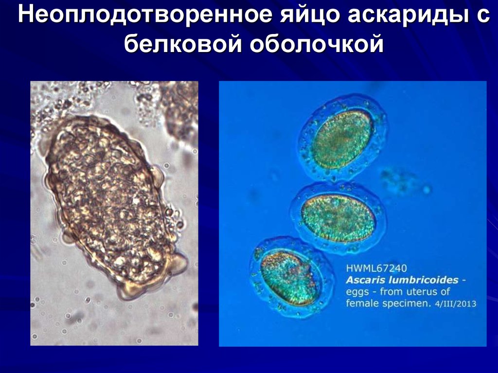 Яйца аскарид. Неоплодотворенное яйцо аскариды. Неоплодотворенное яйцо аскаридыйцо. Яйцо аскариды неоплодотворенное с белковой оболочкой.