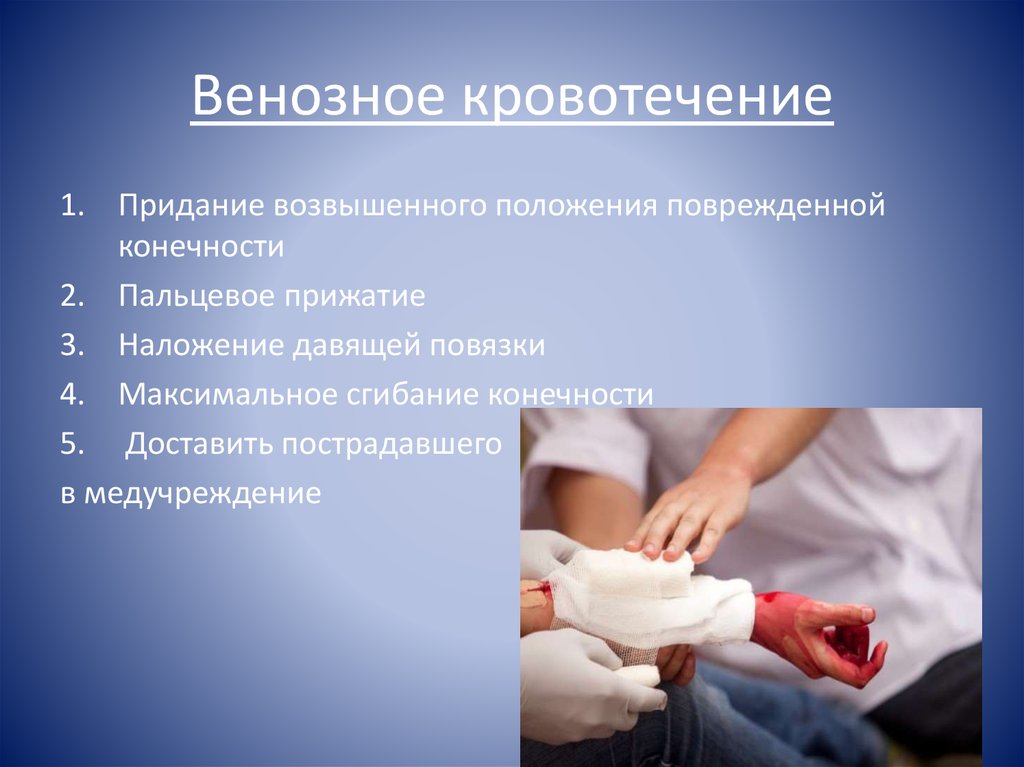 Венозное кровотечение