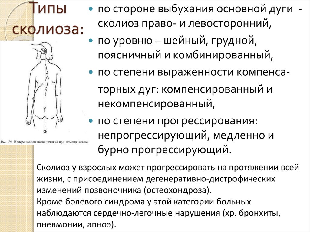 Сколиоз это поправимо проект