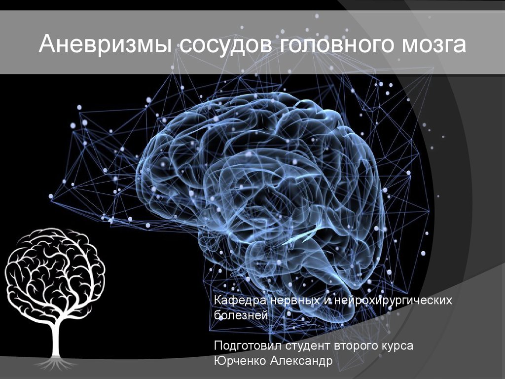 Сосуды головного мозга диета. Аневризмы сосудов головного мозга презентация. Мелкие сосуды головного мозга презентация. Сосуды головного мозга сверху вид.