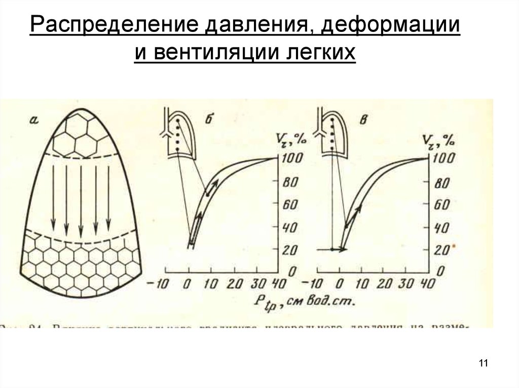 Деформы. Распределение давления. Распределение давления в воздуховоде. Распределения давления на яйце. Распределение давления по частичному съемному протезу.