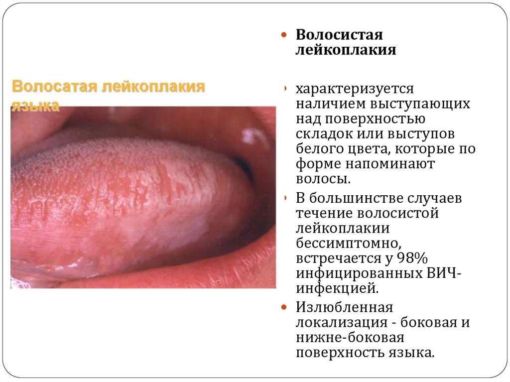 Проявление туберкулеза, сифилиса, дифтерии, ВИЧ-инфекции в полости рта .