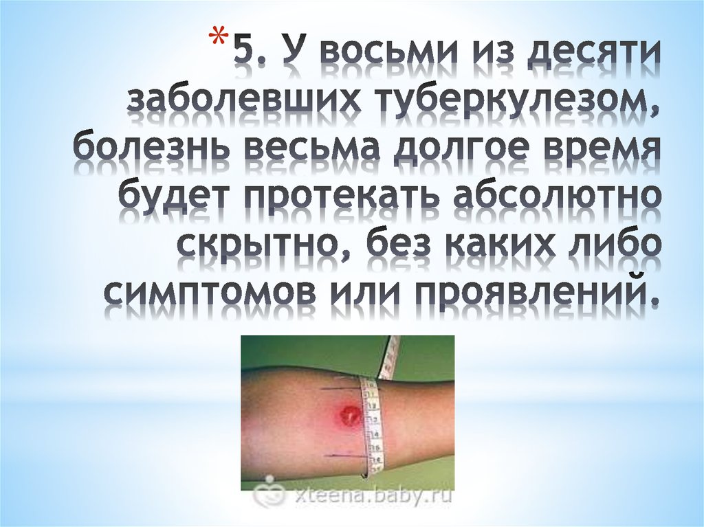 5. У восьми из десяти заболевших туберкулезом, болезнь весьма долгое время будет протекать абсолютно скрытно, без каких либо