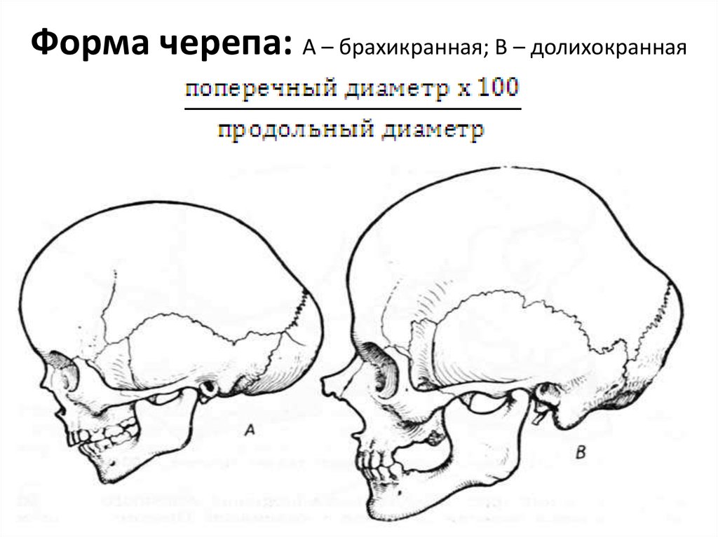 Варианты формы черепа. Форма черепа. Типы формы черепа. Формы черепа человека в норме.