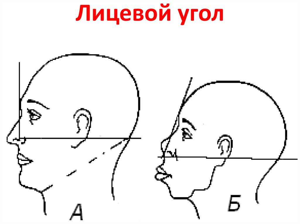 Стань угол. Лицевой угол. Лицевой угол черепа. Лицевой профильный угол. Лицевой угол черепа норма.