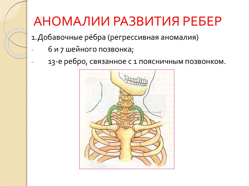 Презентация на тему расщепление позвоночника