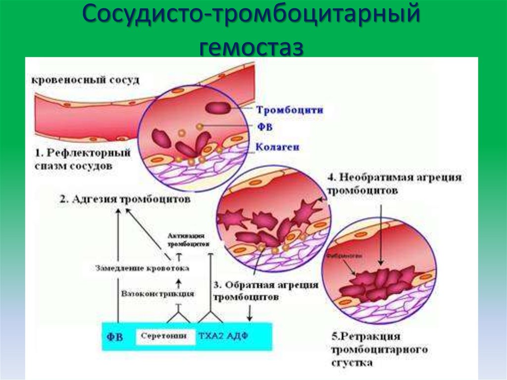 Тромбоциты и тромбы. Схема сосудисто-тромбоцитарного гемостаза. Механизмы тромбообразования сосудисто тромбоцитарный гемостаз. Фазы сосудисто-тромбоцитарного гемостаза. Тромбоцитарный гемостаз схема.