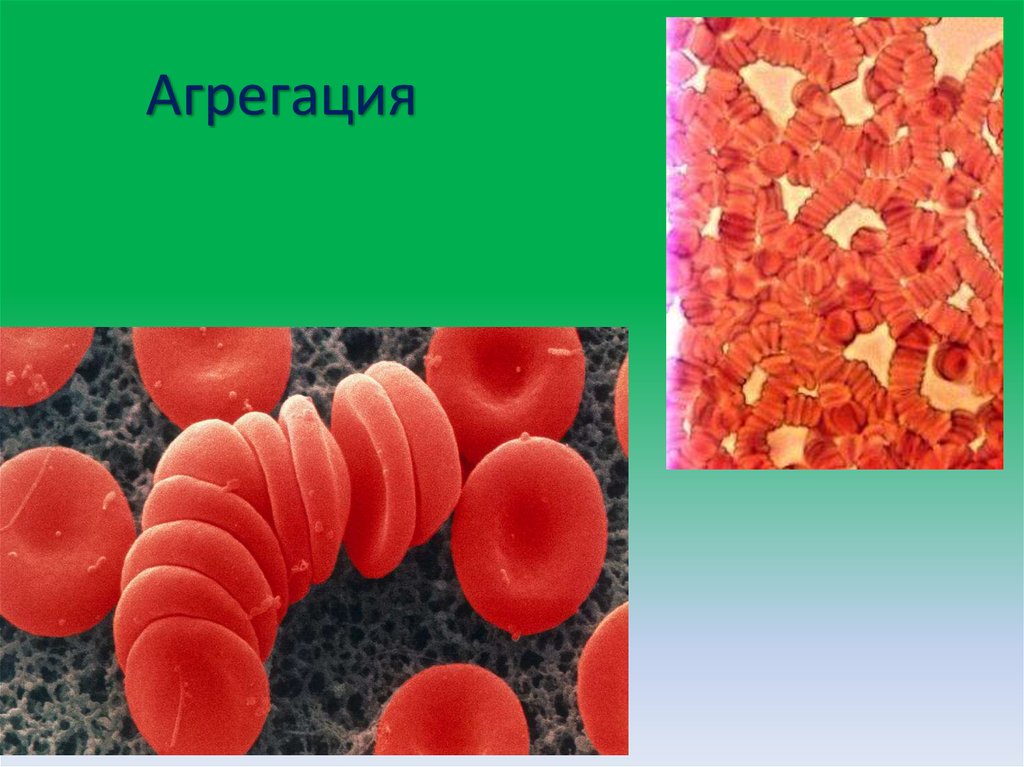 Агрегация эритроцитов это. Агрегация. агрегация это в биологии. агрегация картинки. агрегация это в медицине.