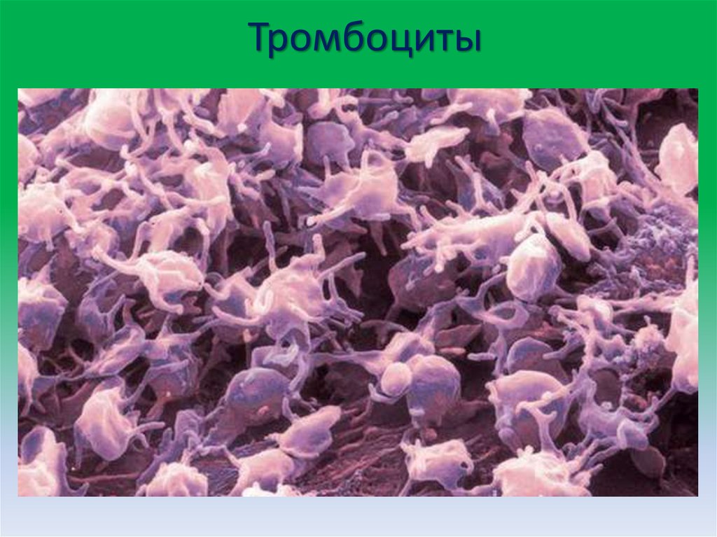 Мелкие безъядерные клетки. Клетка тромбоцита. Тромбоциты в крови человека под микроскопом. Тромбоциты в микроскопе. Тромбоциты человека под микроскопом.