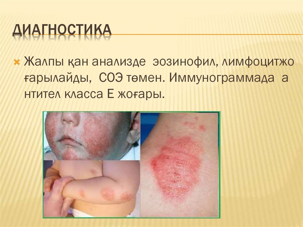 Диагностика 