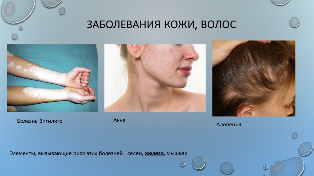 Заболевания кожи, волос