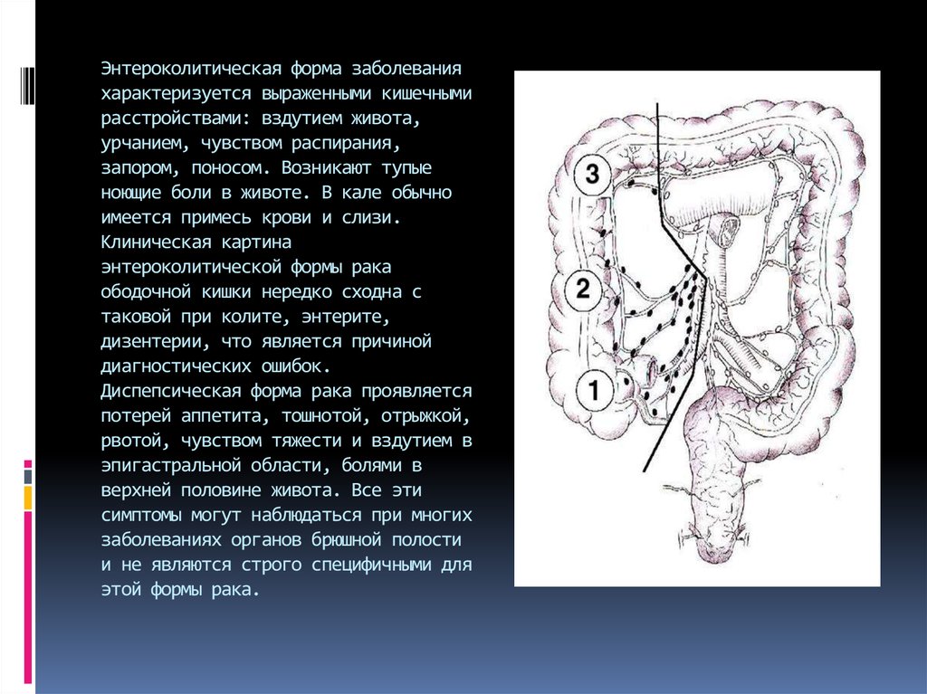 Рак ободочной кишки презентация