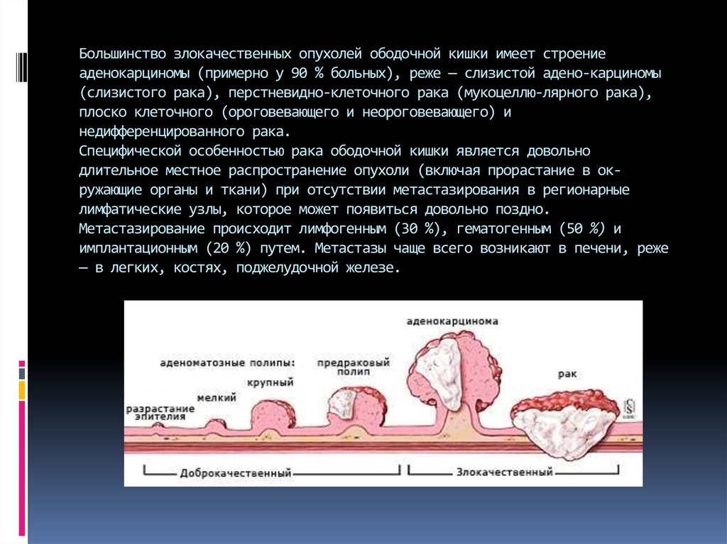 Плоская опухоль схема