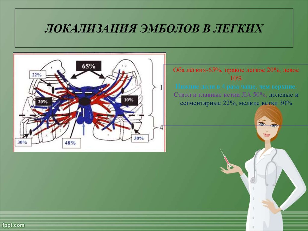 20 легких. Локализация эмболов. Эмболы по локализации примеры. Эмболы в зависимости от локализации. Локализация 13 правая лёгкая.