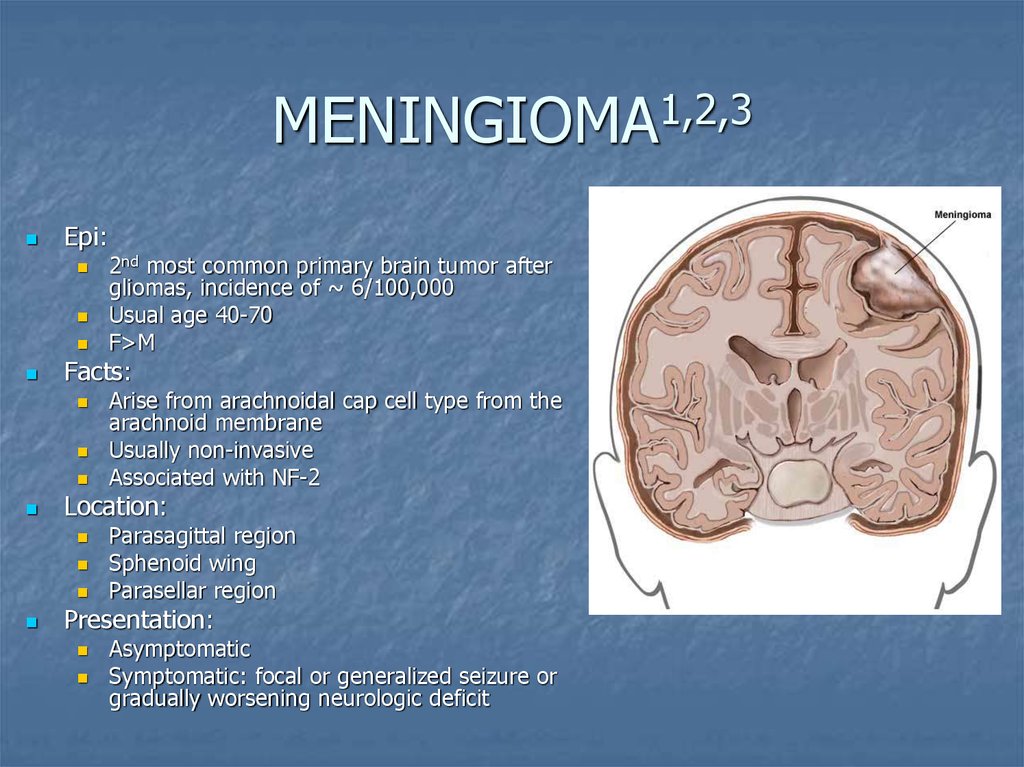 Менингиома это. Менинготелиоматозная менингиома. Менингиома микропрепарат описание. Менингиома гистология описание.