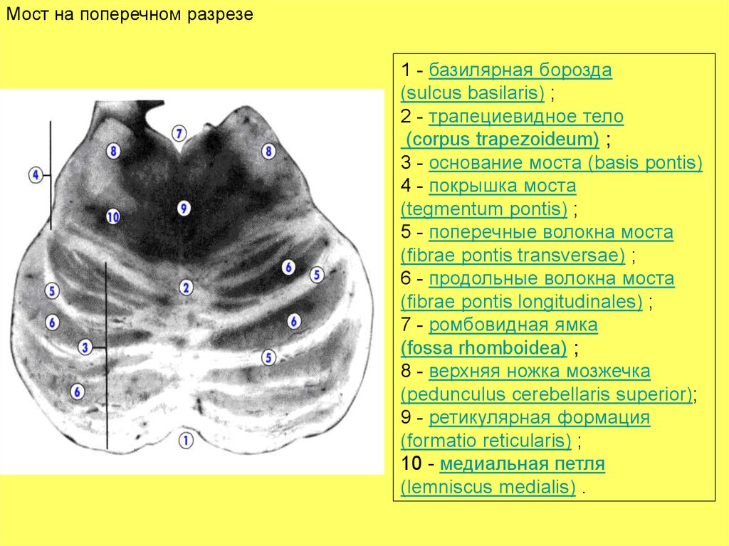 Трапециевидное тело. Corpus trapezoideum трапециевидное тело. Трапециевидное тело на поперечном разрезе моста. Трапецивидное тело мост. Трапециевидное тело моста анатомия.