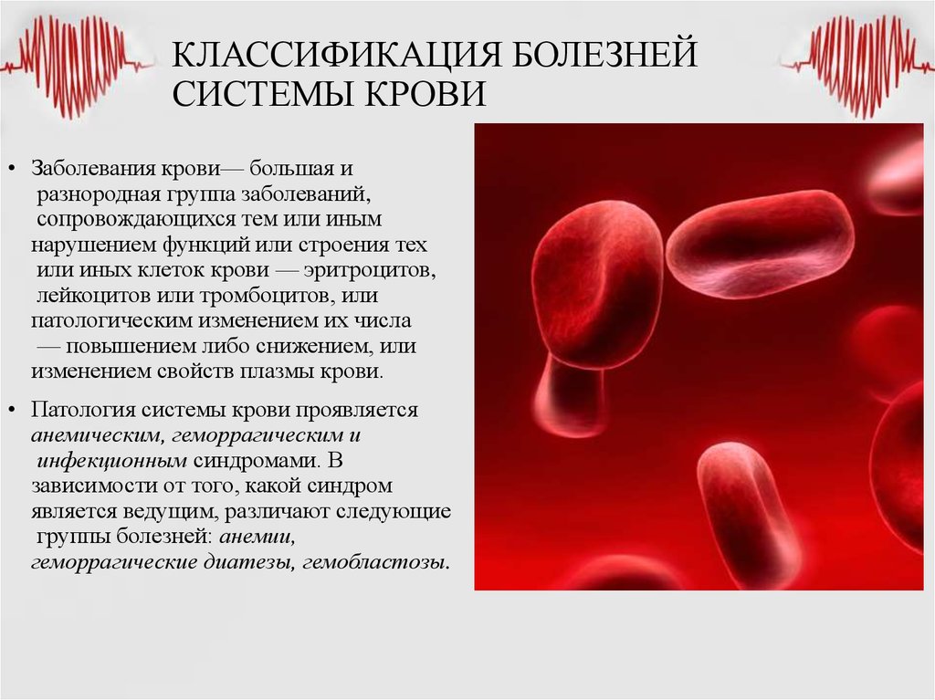 Кровь не сворачивается болезнь. Общая классификация и номенклатура болезней системы крови. Классификация заболеваний крови. Заболевания крови презентация.