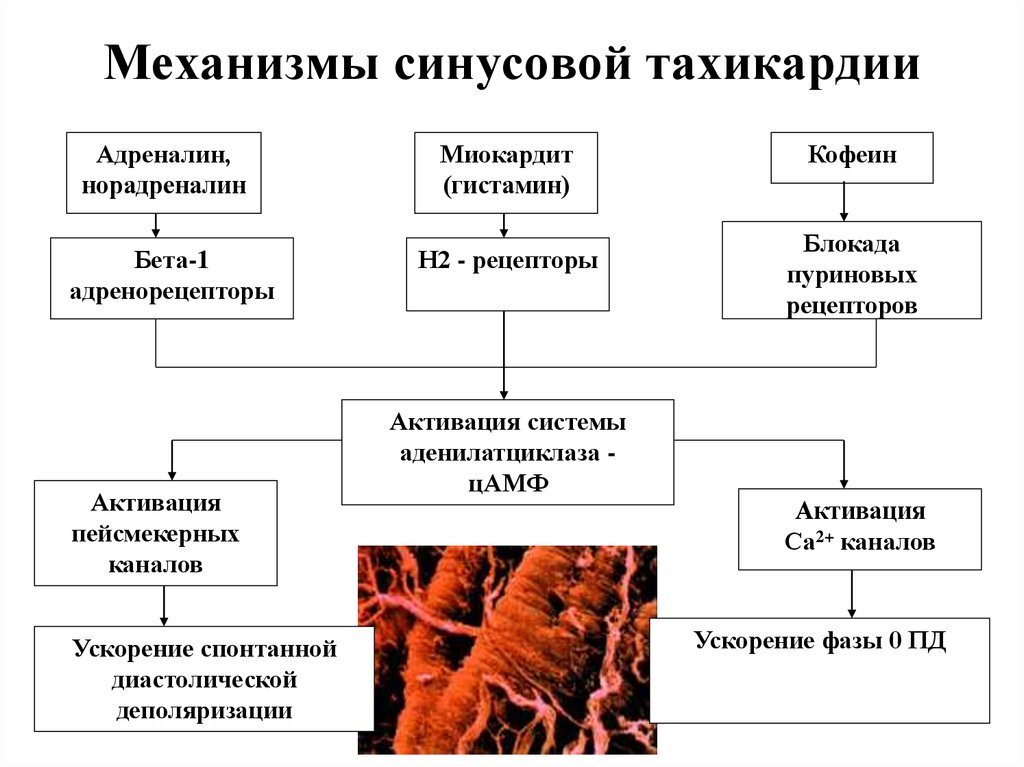 Аритмии патофизиология презентация