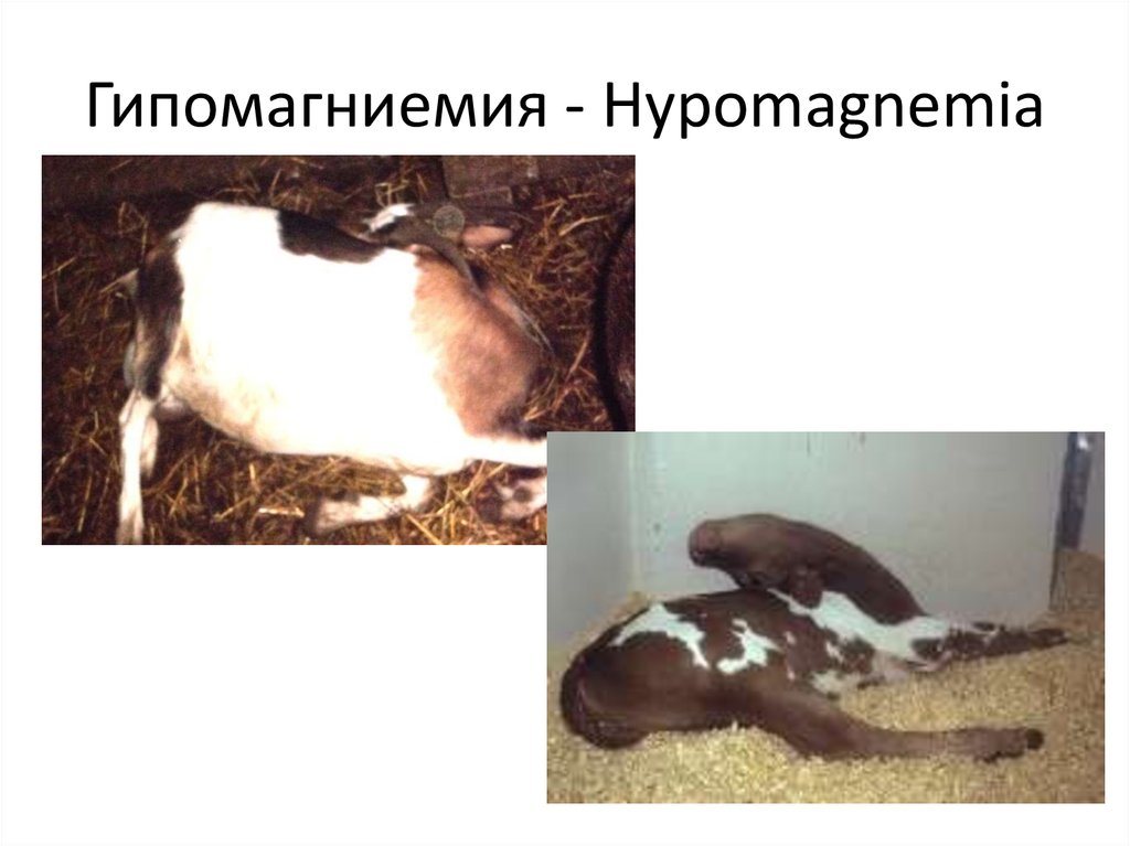 Гипомагниемия - Hypomagnemia