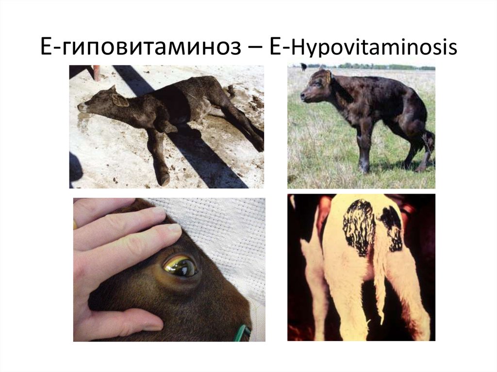 E-гиповитаминоз – Е-Hypovitaminosis