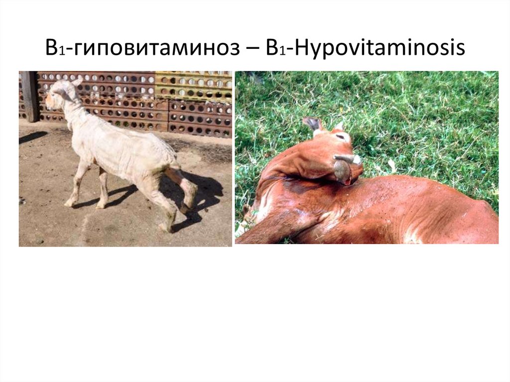 В1-гиповитаминоз – В1-Hypovitaminosis